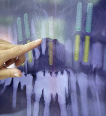 Röntgenbildbeurteilung für Implantate in der Zahnarztpraxis Dres Thomsen und Kollegen Zahnarzt Hamburg